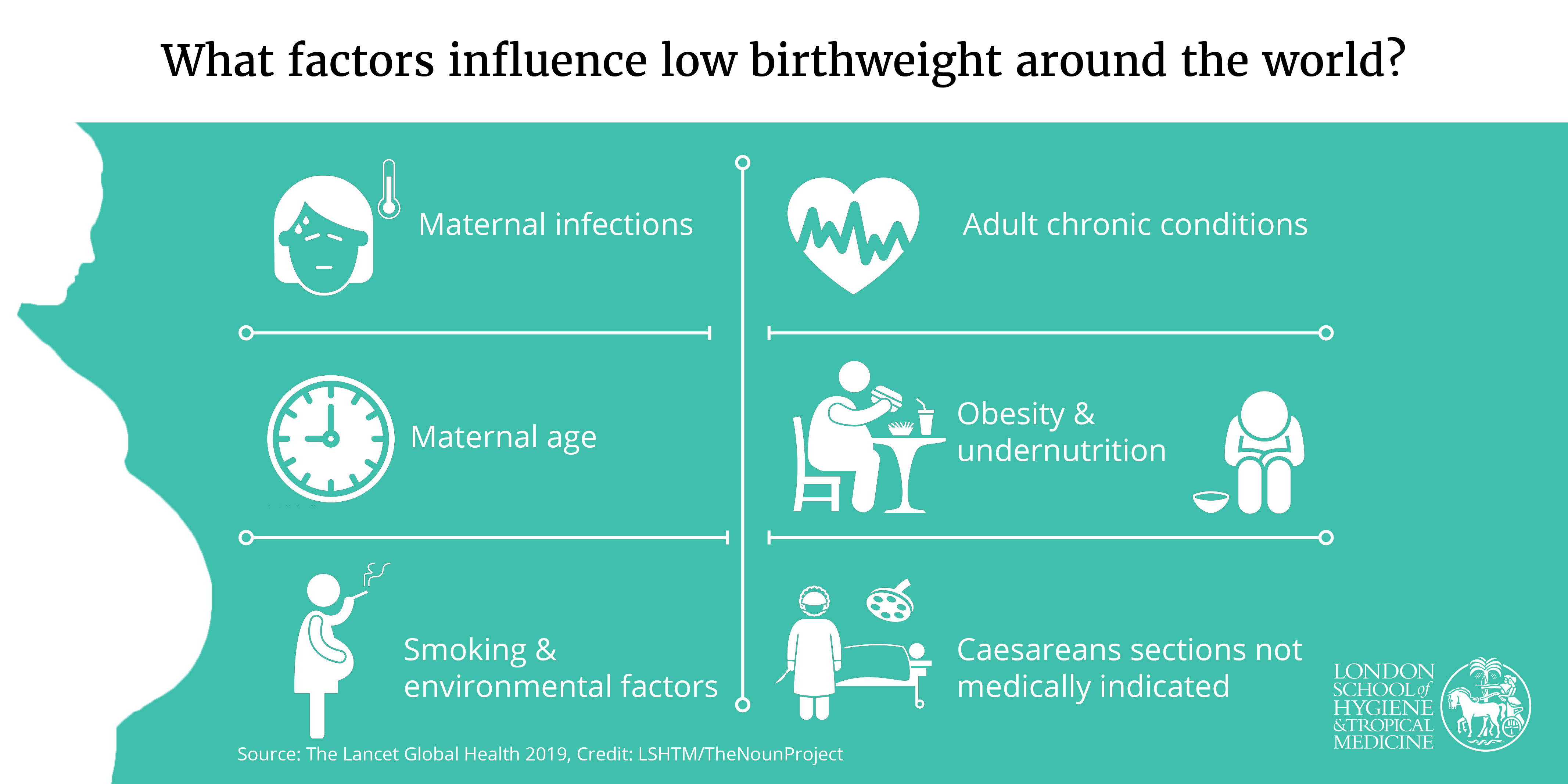 1 In 7 Babies Worldwide Born With A Low Birthweight | LSHTM